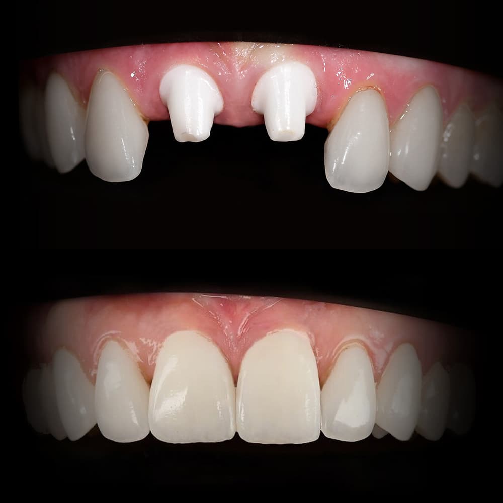 Before and after dental case 12