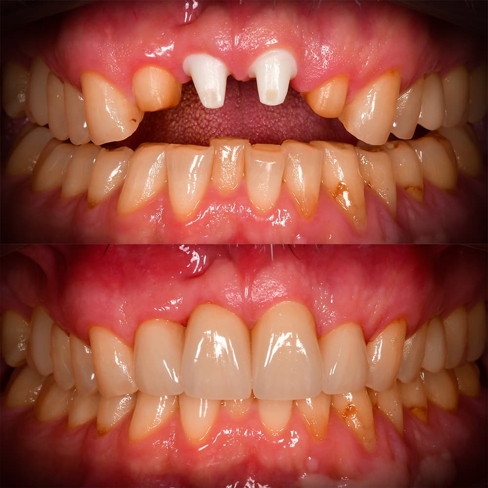 Before and after dental case 7